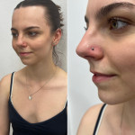 piercing